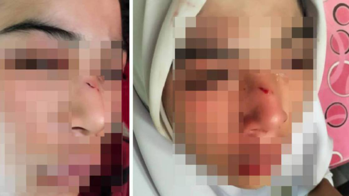 Kelantan Education Department Launches Probe Into Alleged Student Assault