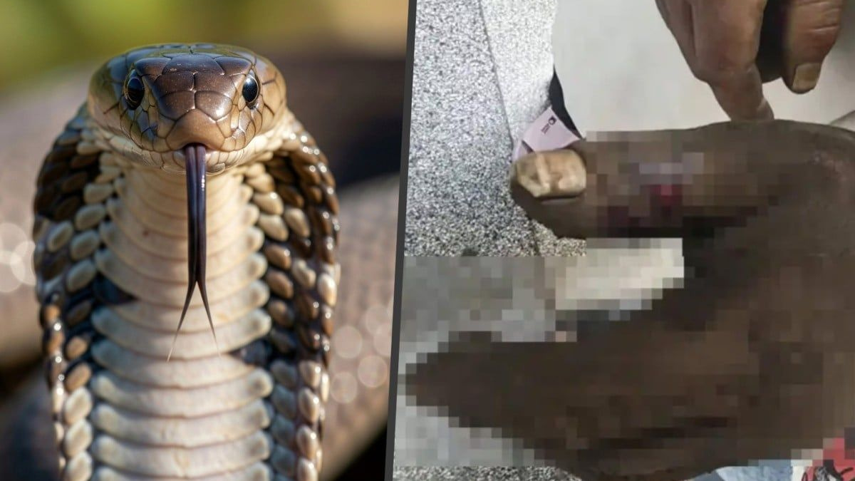 Chinese wife's well-intentioned snake bite remedy backfires, poisoning herself
