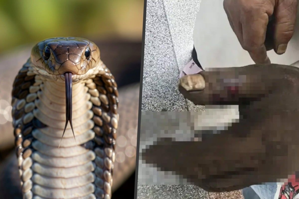 Chinese wife's well-intentioned snake bite remedy backfires, poisoning herself