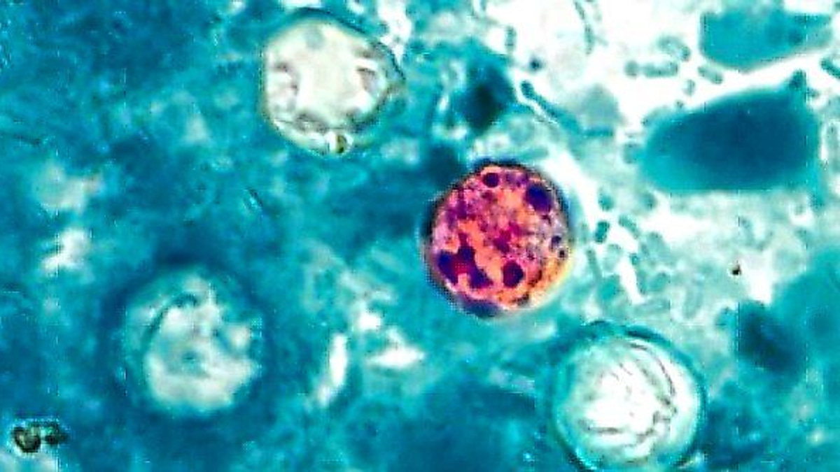 The Detection Puzzle: Why Cyclospora Outbreaks Are So Hard to Track Down