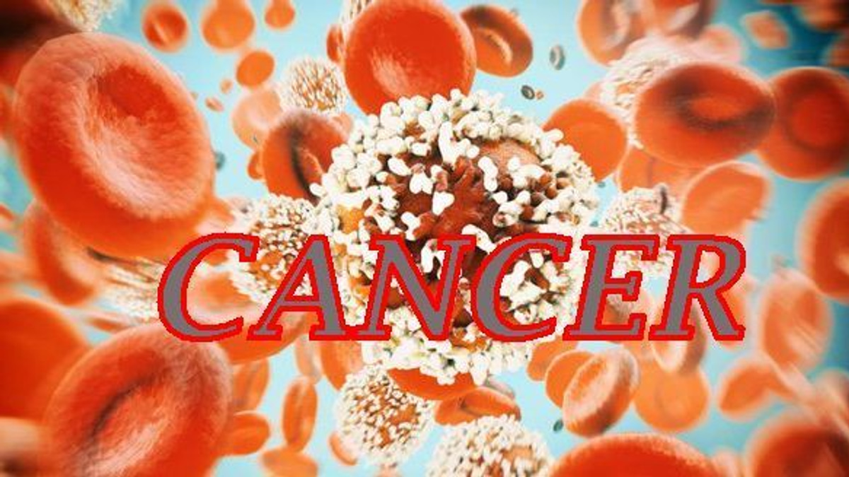 The Hidden Crisis: Why Young People Are Increasingly Developing Colorectal Cancer