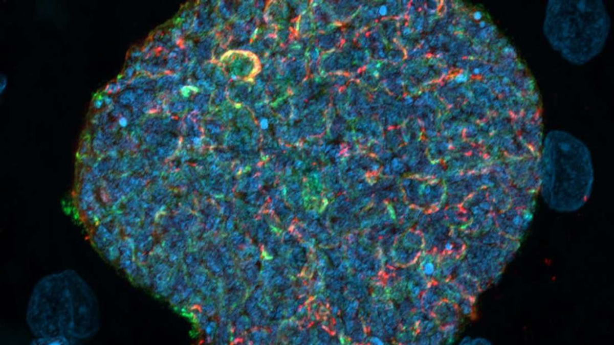 Australian Researchers Develop Strategy to Transform Mosquito Bites Into Malaria Immunity Boosters