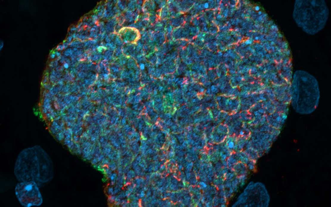 Australian Researchers Develop Strategy to Transform Mosquito Bites Into Malaria Immunity Boosters