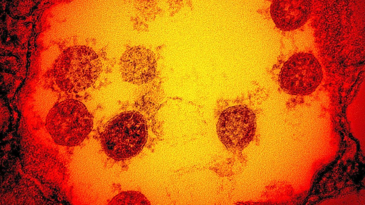 Cambridge Scientists Develop 'Master Key' Vaccine Technology to Combat Virus Families